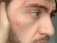 Il fait ses courses à Charleroi et se fait frapper car il est homo: “Sale gros pédé”