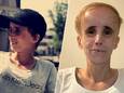 Charlotte De Smedt, die lijdt aan een “soort van progeria”, is terug ontwaakt uit de kunstmatige coma, maar staat voor een zware revalidatie.