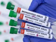 Roche développe des tests PCR pour détecter la variole du singe