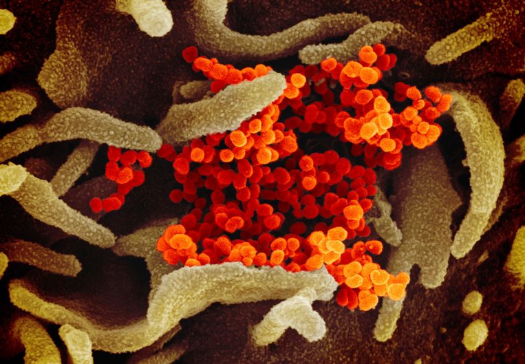 Op een microscoopbeeld van het Amerikaanse nationale gezondheidsinstituut is het nieuwe coronavirus te zien als oranje bolletjes die tevoorschijn komen uit groene cellen. Beeld AP