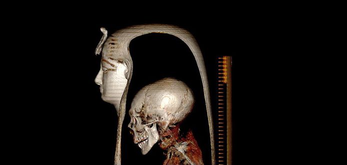 Amenhotep was 35 jaar oud toen hij stierf. Hij was ongeveer 169 centimeter groot en zijn tanden waren in uitstekende staat.