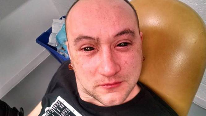 Gekke wetenschapper vormt zijn ogen om tot nachtkijkers