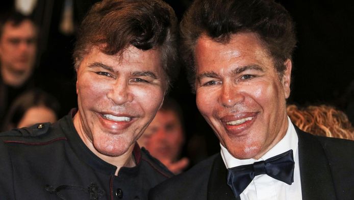 chirurgie detournement d argent les freres bogdanoff repondent people 7sur7 be