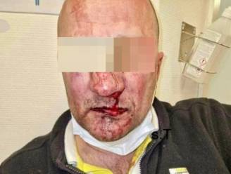 “Hij werd uit de bus gesleurd en voor dood achtergelaten”: na zware agressie tegen De Lijn-chauffeur eisen vakbonden maatregelen