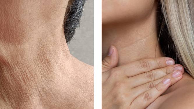 "Je decolleté verraadt je ware leeftijd": 4 experten leggen uit wat helpt tegen nekrimpels of de 'kalkoennek’
