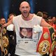 Wereldkampioen boksen Tyson Fury aangeklaagd wegens dopinggebruik