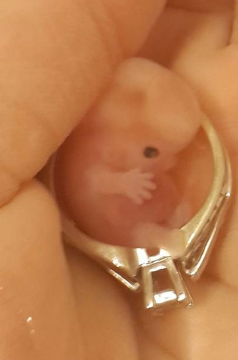 Ребенок ребенка 6 8 недель. Медикаментозный аборт эмбрион. Плод при медикаментозном аборте.