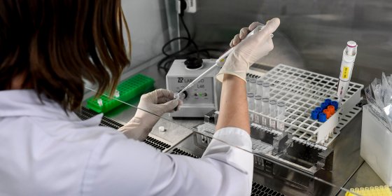 Onderzoek UGent: ‘Genetische verschillen verklaren waarom sommige landen zwaarder getroffen zijn’