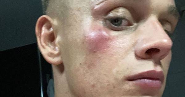 Enschedese burgemeester roept op tot waakzaamheid na mishandeling journalist Dennis Schouten.