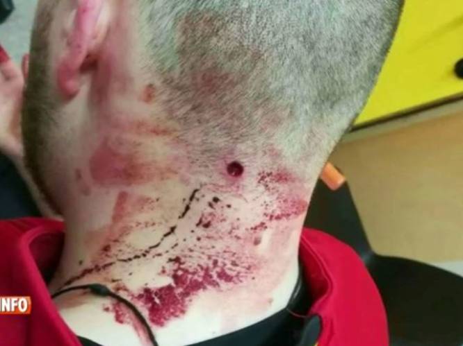 Jongeman beschoten tijdens jogging in Borgworm: "Het scheelde geen haar of ik was dood"