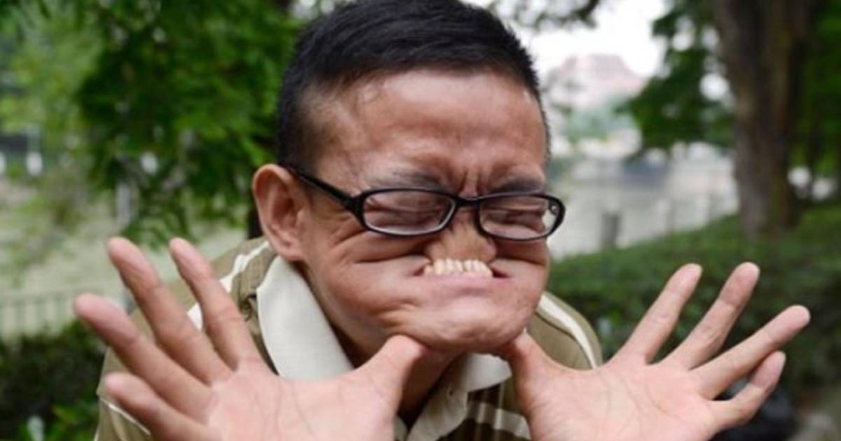 L