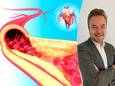 Algemeen directeur van de Belgische Cardiologische Liga Rik Vanhoof informeert over atherosclerose, de miskende ziekte die jaarlijks een groot aantal slachtoffers maakt.