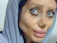 Sahar viel 40 kilo af en onderging 50 operaties om op Angelina Jolie te lijken. Het (voorlopige) resultaat is schrikbarend