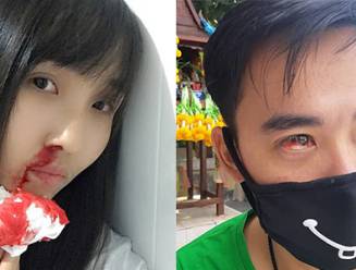 Luchtvervuiling in Bangkok zo erg dat inwoners bloed ophoesten