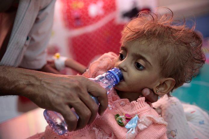 Een vader probeert zijn zwaar ondervoede dochtertje de fles te geven in Hodeida in Jemen. Sinds het uitbreken van de burgeroorlog in Jemen in 2015 zijn al zo'n 85.000 kinderen onder de vijf jaar overleden door hongersnood en ziekten.