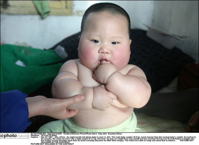 L Oms Met En Garde Contre Une Hausse De L Obesite Infantile Foto 7sur7 Be