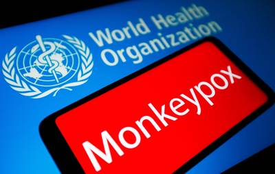 Le risque transmission entre humains de la variole du singe est “très faible”