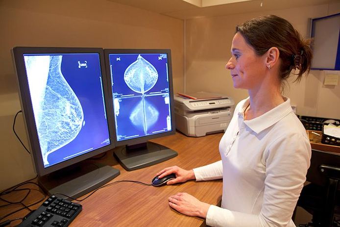 Een radiologe analyseert een mammogram.