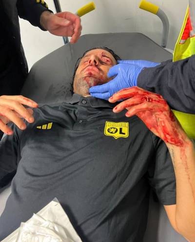 KIJK. Lyon-coach bloedend van spelersbus gehaald nadat ramen met stenen werden ingegooid, match afgelast