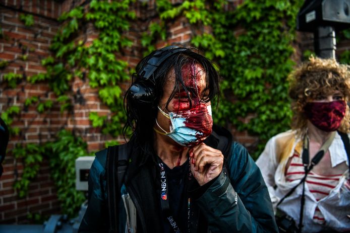 Een journaliste met bebloed gezicht nadat de politie traangas en rubberkogels afvuurde tijdens de protesten in Minneapolis.
