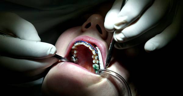 Orthodontist zutphen