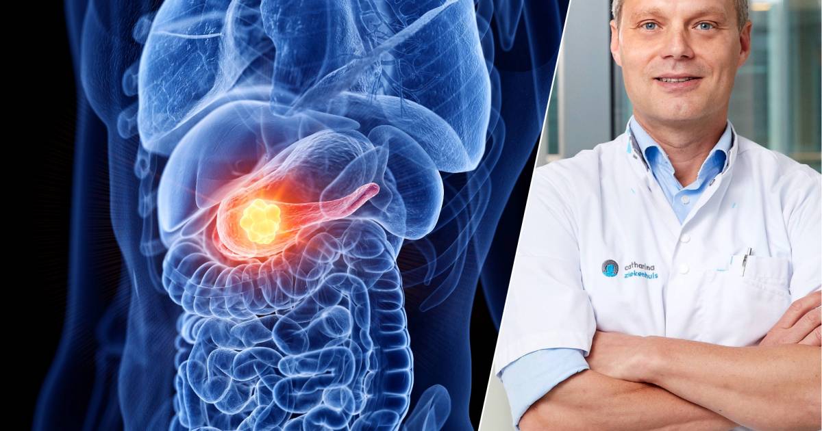 Understanding Pancreatic Cancer: Insights from Oncological Surgeon Ignace de Hingh