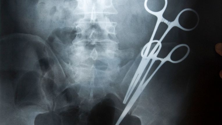 Glen G. (50) heeft een jaar rondgelopen met twee 'vergeten' scharen van 16cm in zijn onderbuik. De chirurg was die uit zijn lichaam vergeten te halen tijdens een darmoperatie. Beeld Photo News