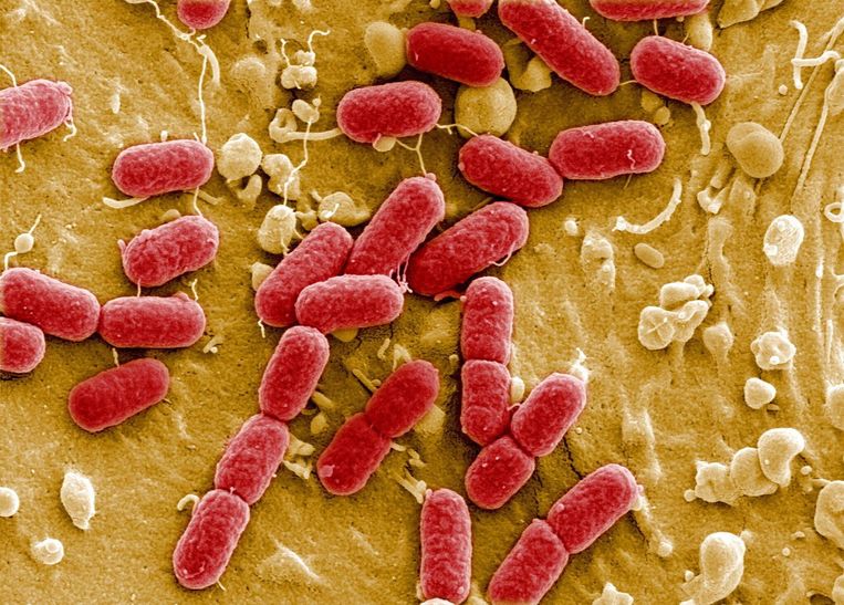 Escherichia coli. Beeld Helmholtz Centre for Infectious Diseases