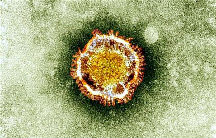 Het SARS-virus onder een microscoop.