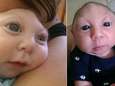 Un "miracle": ce bébé fête son premier anniversaire