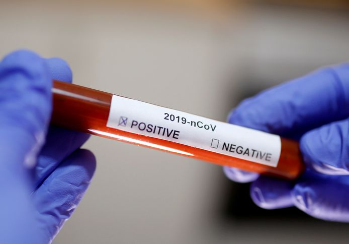 De doelgroep voor testen op coronavirus is donderdagavond aangepast.