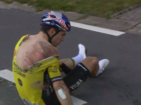 Wout van Aert opéré avec succès, sa participation au Giro est “incertaine”