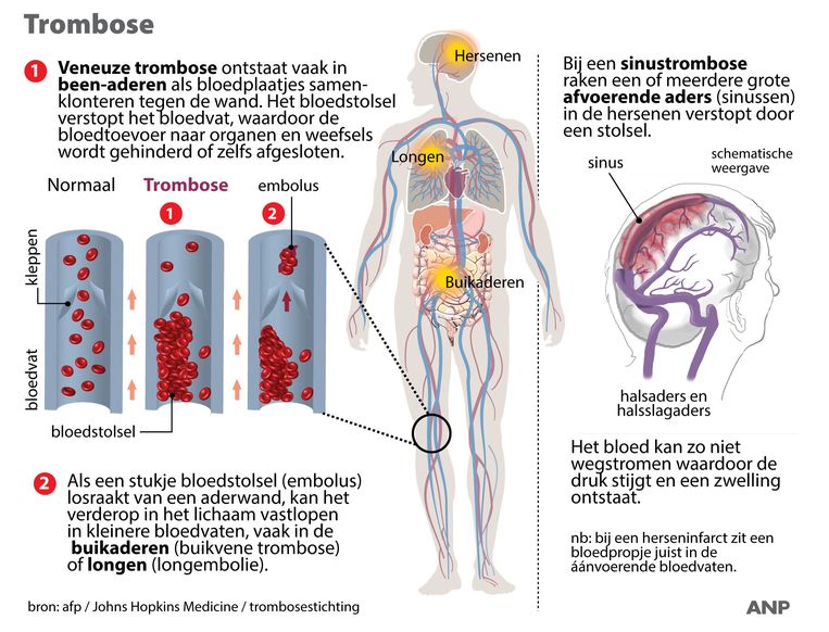 Hoe zit het precies met die enge bloedklonters bij AstraZeneca en J&J ...