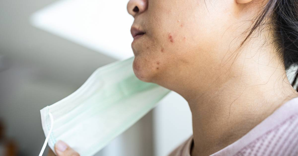 Puistjes En Schimmel Door Mondkapjes Mascne Bestaat Echt Binnenland Ad Nl