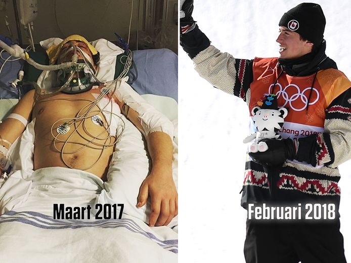 Mark McMorris.