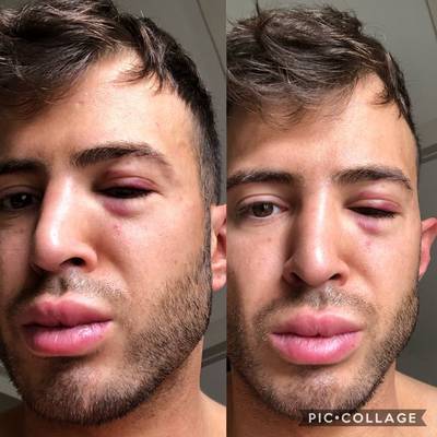 Stylist Chiel Harten in elkaar geslagen en beroofd