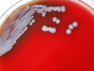 Verenigde Staten vinden voor het eerst mogelijk dodelijke bacterie in bodem- en waterstalen 