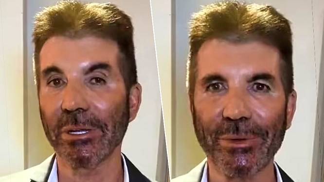 “Wat is er met zijn gezicht gebeurd?”: fans bezorgd om ‘onherkenbare’ Simon Cowell