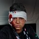 Staakt-het-vuren in Idlib, maar lang geen vrede