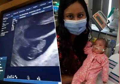 Jongste tweeling ooit wordt geboren na amper 22 weken: “overlevingskansen waren nihil”