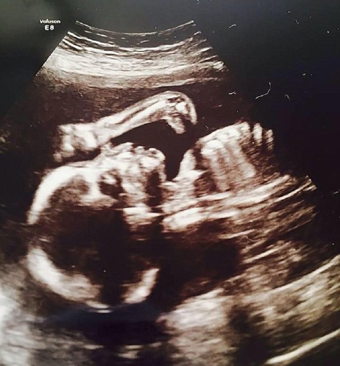 Un Drole D Invite Sur Son Echographie Famille 7sur7 Be