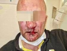 Chauffeur geslagen, uit de bus gesleurd en voor dood achtergelaten, zijn collega’s leggen het werk neer