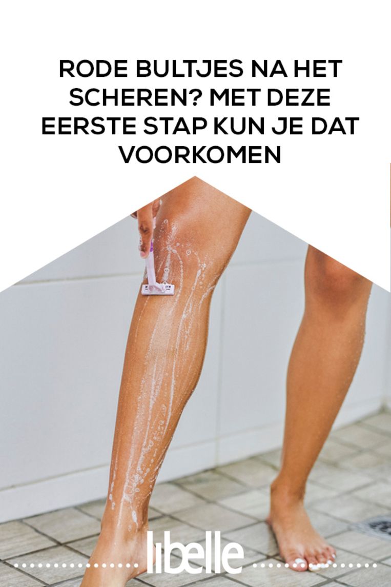 Rode bultjes na het scheren? Met deze eerste stap kun je dat voorkomen
