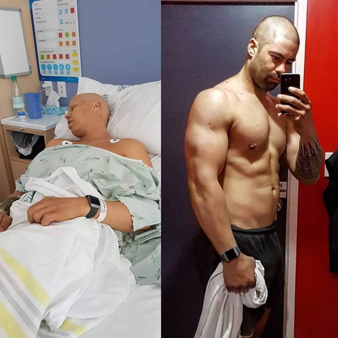 Gary-John tijdens zijn verblijf in het ziekenhuis (links) en een maand nadat hij genezen was verklaard (rechts). In 4 weken tijd ging hij van 89 naar 106 kilogram. Ook zijn haar begon opnieuw te groeien.