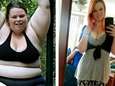 Kayla viel 88 kilo af. En nu zit ze met een enorm ongemak