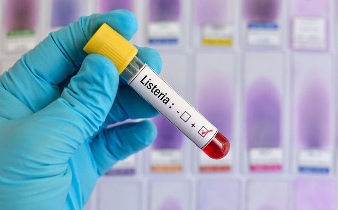 Een ampul bloed dat positief getest is op de levensgevaarlijke listeriabacterie.