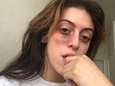 Frappée devant chez elle par un inconnu, Clara affiche son visage tuméfié sur Twitter: “Éduquez vos fils”
