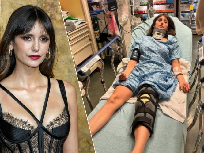 ‘Vampire Diaries’-ster Nina Dobrev in ziekenhuis na motor-ongeluk: “Lange lijdensweg voor de boeg”