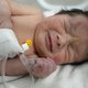 Pasgeboren baby die nog met navelstreng vasthing gered vanonder het puin in Syrië
