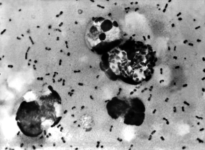 De Pestbacterie yersinia pestis